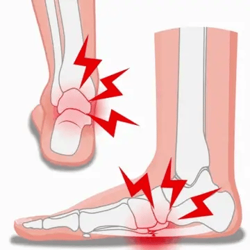 ORTHOPAEDIC INSOLES | Shock-Absorbing insoles for plantar pain