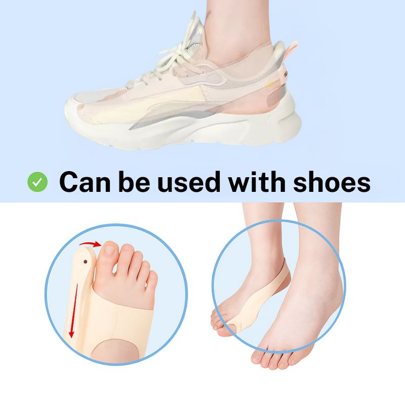 ORTHOSOFT | Discreet orthosis for hallux valgus