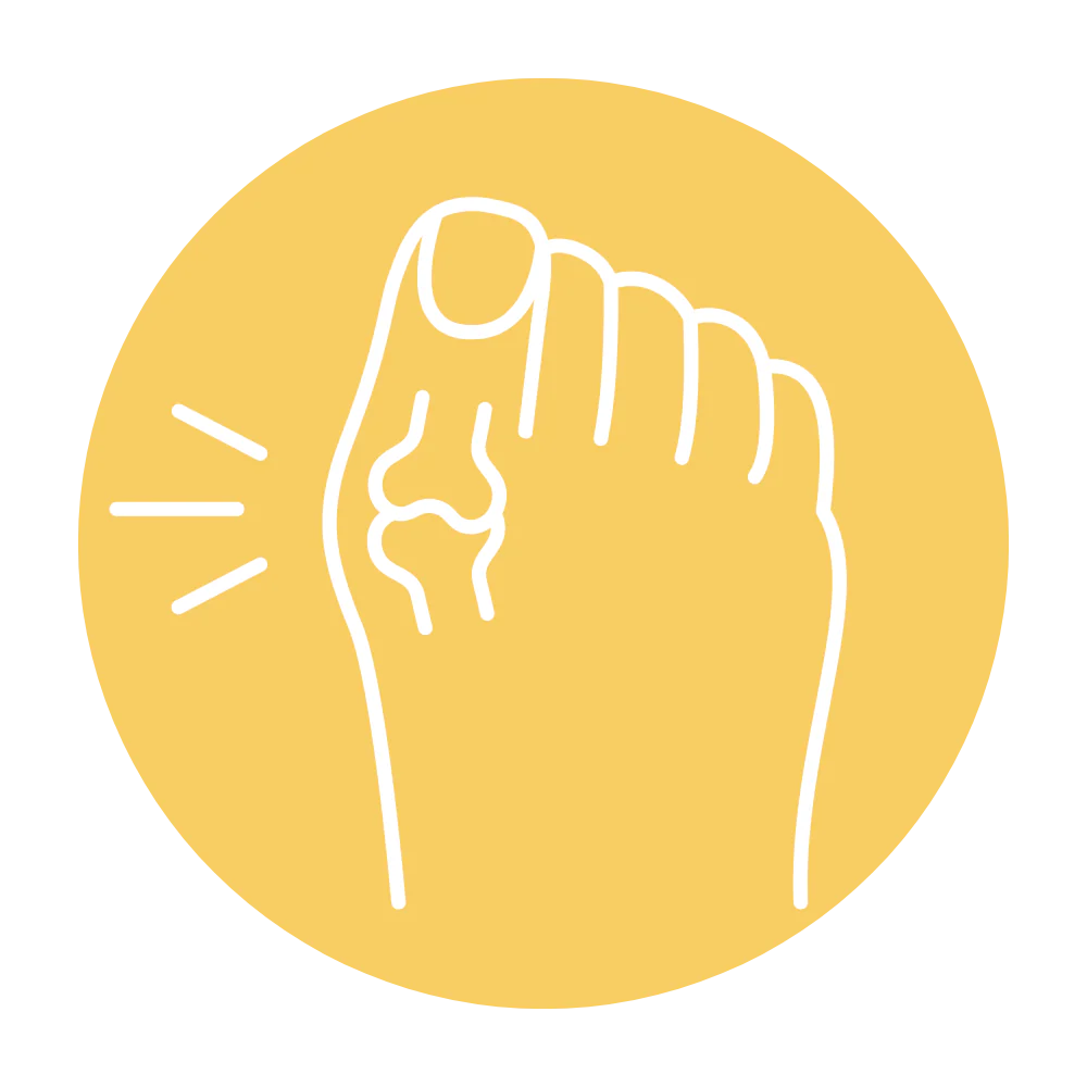 Prevention of Corns and Calluses